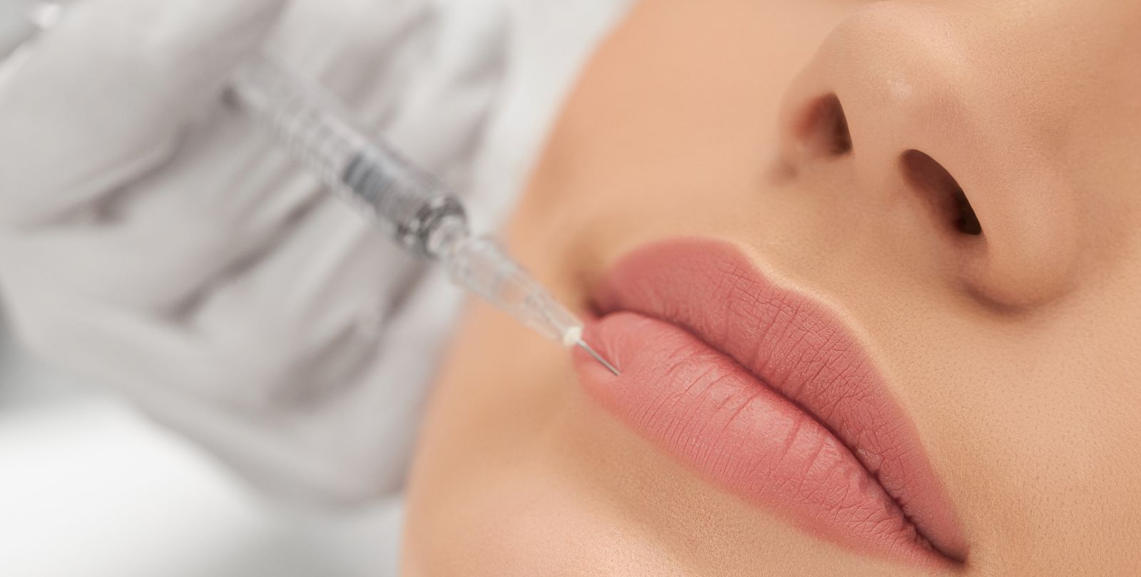 Lip Filler techniques and when to select each one.
